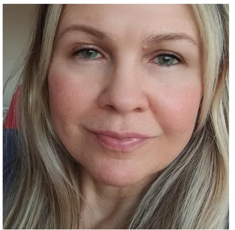 Aline A., 47 anos